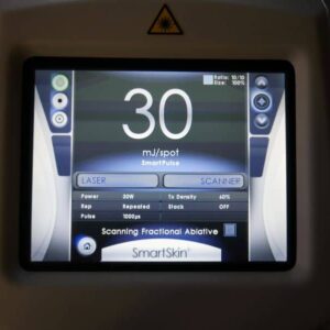 Cynosure Smartskin+