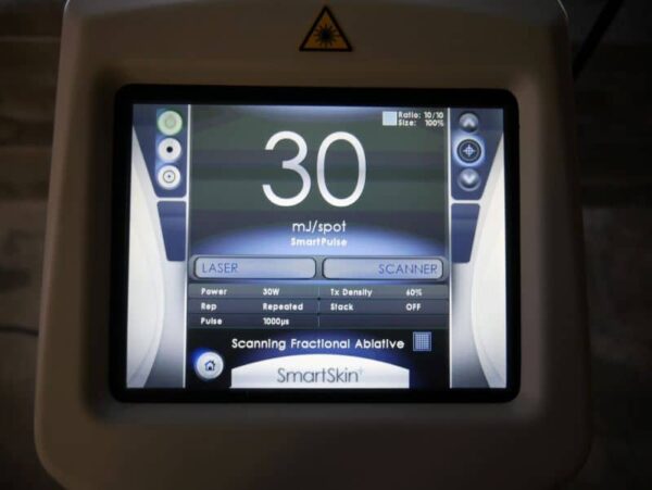 Cynosure Smartskin+